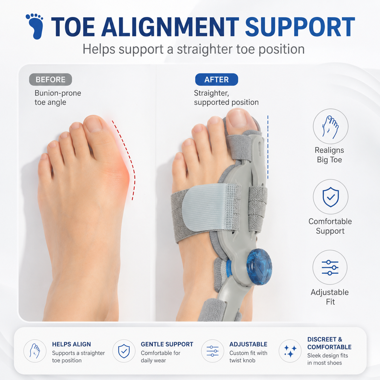 🦶 Adjustable Toe Valgus Corrector for Bunion Relief & Toe Alignment-9SLL