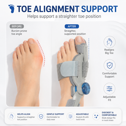 🦶 Adjustable Toe Valgus Corrector for Bunion Relief & Toe Alignment-9SLL